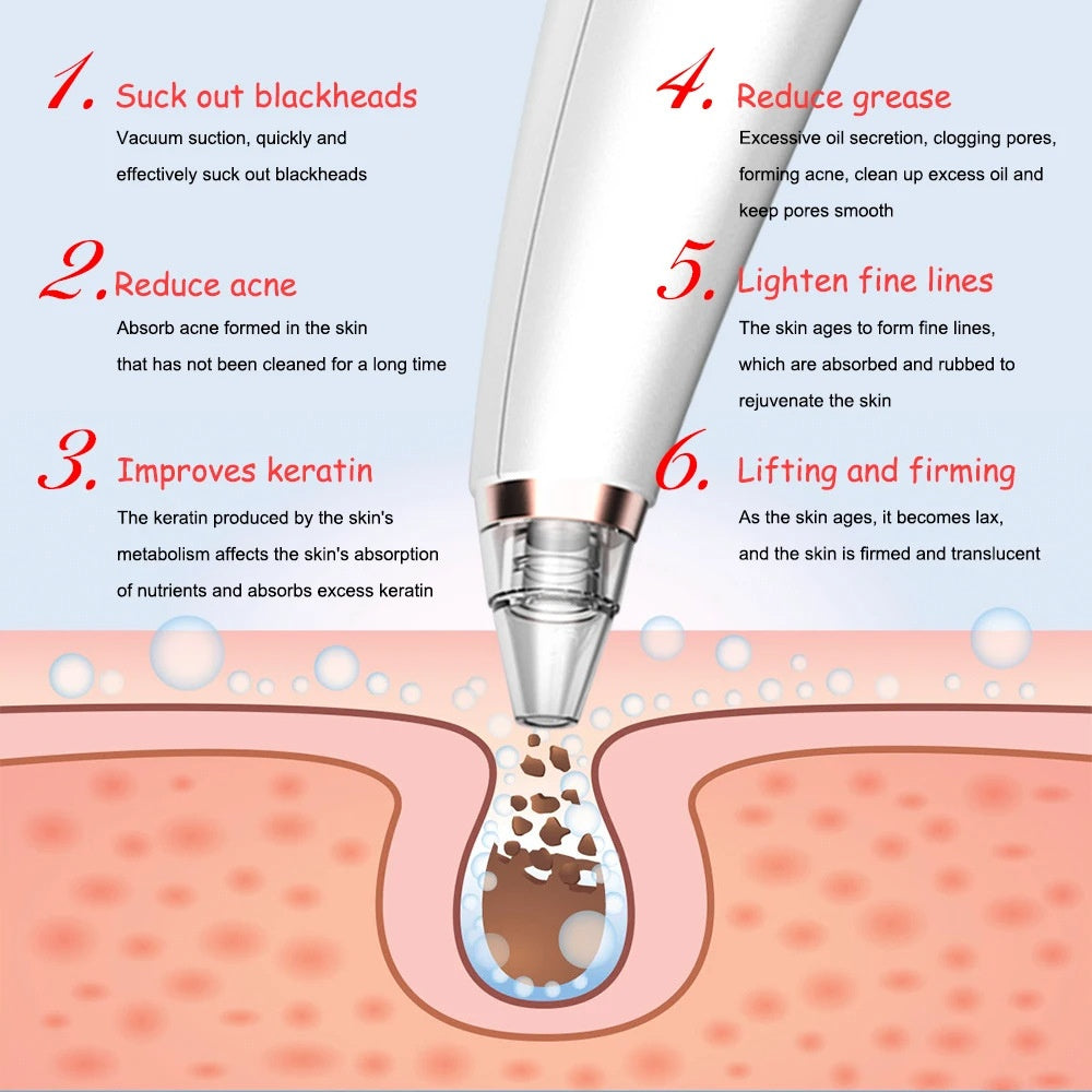 New electric blackhead removal and pore cleaning for blackheads